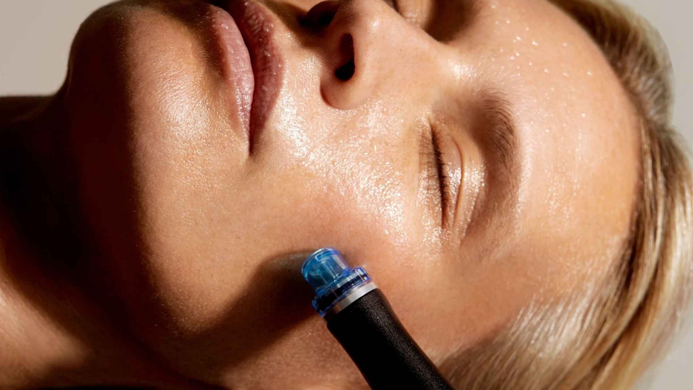 HydraFacial in Hertfordshire: Discover Radiant Skin at Odyssey Spa