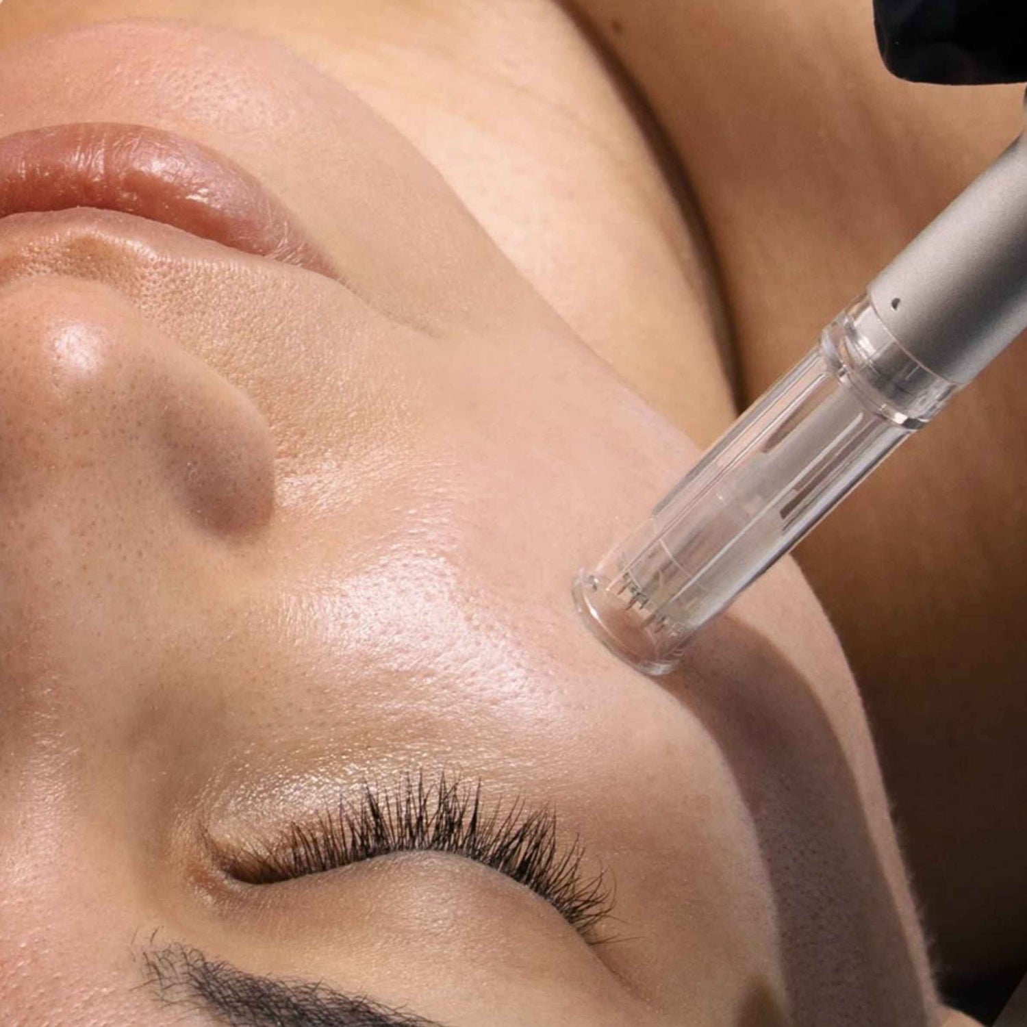 Close-up of a person's face with a clear handheld cosmetic applicator touching the cheek, showing skin texture and a small amount of product being applied.