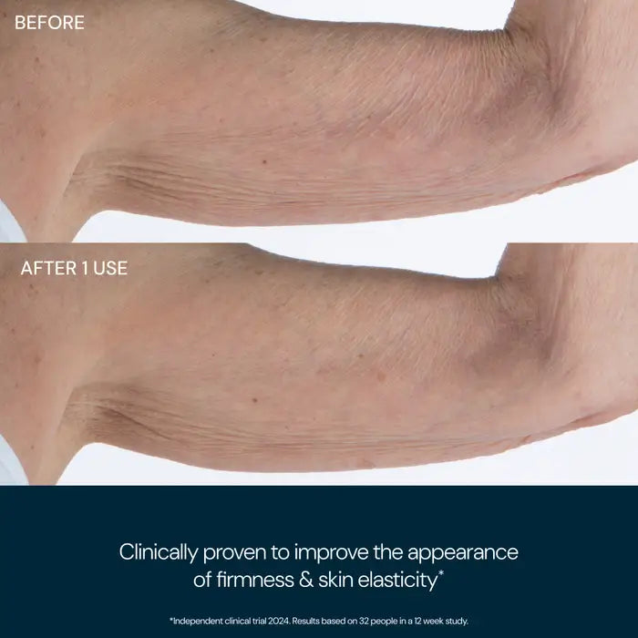 Before and after comparison of skin texture on an arm with text indicating improvement.